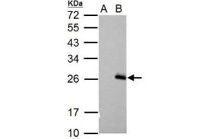 Image no. 1 for anti-Regulator of G-Protein Signaling 17 (RGS17) (C-Term) antibody (ABIN2856380)