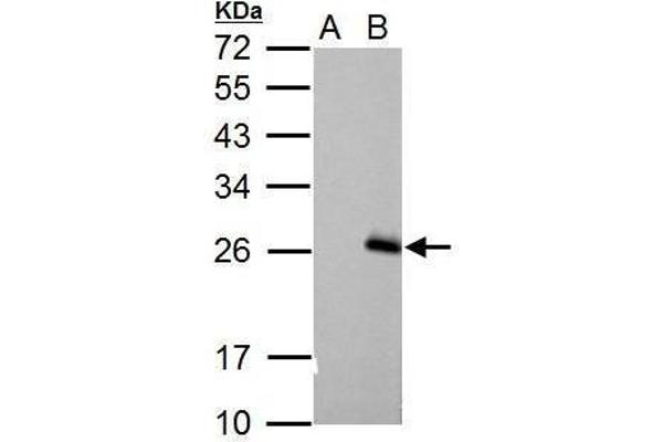 RGS17 antibody  (C-Term)