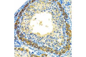Image no. 1 for anti-Mitochondrial Ribosomal Protein L28 (MRPL28) antibody (ABIN6144010)
