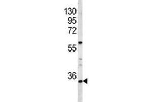 Image no. 2 for anti-Homeobox A9 (HOXA9) (AA 245-272) antibody (ABIN3028722)