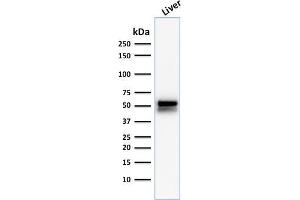 Image no. 5 for anti-Aldehyde Dehydrogenase 1 Family, Member A1 (ALDH1A1) (AA 315-434) antibody (ABIN6939366)