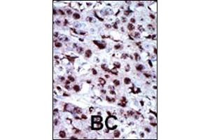 Image no. 1 for anti-Adenylate Kinase 5 (AK5) (AA 404-433), (N-Term) antibody (ABIN392733)