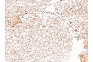 Image no. 2 for anti-Fibroblast Growth Factor Receptor Substrate 2 (FRS2) (pTyr196) antibody (ABIN6271560)