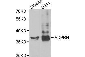 Image no. 1 for anti-ADP-Ribosylarginine Hydrolase (ADPRH) antibody (ABIN1980293)