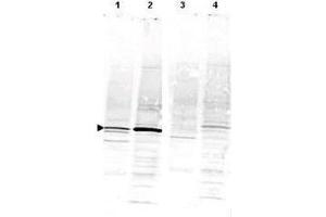 Western blot using  Anti-CaM Kinase IV antibody shows detection of a band ~52 kDa corresponding to CaM Kinase IV (arrowhead) in various preparations: lane 1 - rat brain lysate, lane 2 - Jurkat cell lysate.