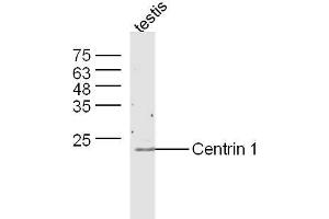 Mouse testis lysates probed with Anti-Centrin 1 Polyclonal Antibody, Unconjugated  at 1:300 overnight at 4˚C.