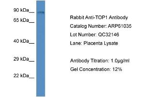 Image no. 1 for anti-Topoisomerase (DNA) I (TOP1) (N-Term) antibody (ABIN2788658)