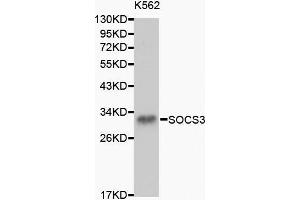 Image no. 1 for anti-Suppressor of Cytokine Signaling 3 (SOCS3) (pSer3) antibody (ABIN3021100)