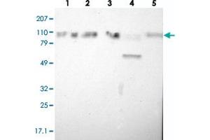 Image no. 3 for anti-SMEK Homolog 2, Suppressor of Mek1 (Dictyostelium) (SMEK2) antibody (ABIN5588430)