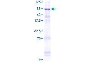 Image no. 1 for Tubulointerstitial Nephritis Antigen (TINAG) (AA 1-476) protein (GST tag) (ABIN1322799)