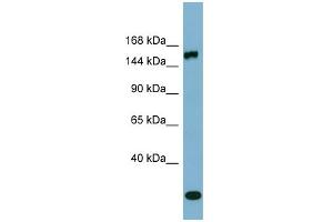 anti-Glutamyl-Prolyl-tRNA Synthetase (EPRS) (Middle Region) antibody