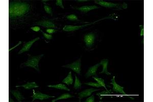 Immunofluorescence of purified MaxPab antibody to PPIL2 on HeLa cell.
