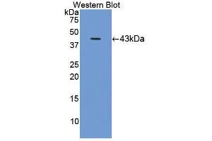 Image no. 1 for anti-Complement Component 8, beta Polypeptide (C8B) (AA 161-503) antibody (ABIN5013381)
