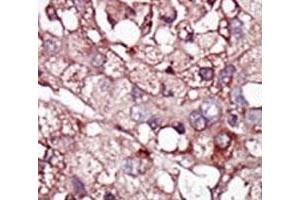 Image no. 5 for anti-Activin A Receptor Type II-Like 1 (ACVRL1) (AA 38-68) antibody (ABIN3029853)