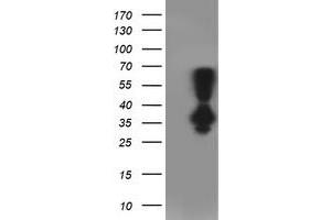 Image no. 5 for anti-Phenylethanolamine N-Methyltransferase (PNMT) antibody (ABIN1500315)