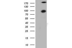 anti-Protein Kinase D2 (PKD2) antibody