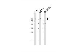 Image no. 3 for anti-Dystroglycan 1 (DAG1) (AA 718-747), (C-Term) antibody (ABIN658022)