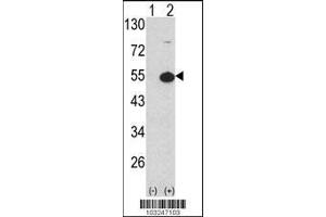 Image no. 2 for anti-Protein Kinase A, alpha (PRKACA) (AA 1-30), (N-Term), (Regulatory Subunit 1) antibody (ABIN392680)