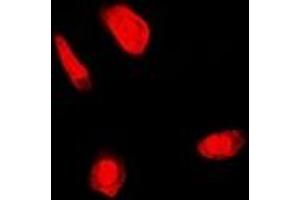 Image no. 1 for anti-Fanconi Anemia, Complementation Group C (FANCC) antibody (ABIN2966625)