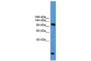 Image no. 1 for anti-Ubiquitin Specific Peptidase 15 (USP15) (C-Term) antibody (ABIN2788019)