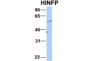 Image no. 2 for anti-Histone H4 Transcription Factor (HINFP) (Middle Region) antibody (ABIN2779711)
