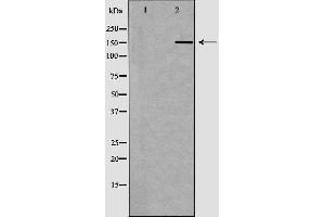Image no. 4 for anti-MutS Homolog 6 (E. Coli) (MSH6) antibody (ABIN6263386)