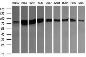 Image no. 3 for anti-CD22 Molecule (CD22) antibody (ABIN1497211)