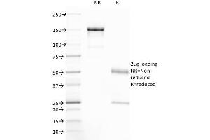 Image no. 1 for anti-Cystic Fibrosis Transmembrane Conductance Regulator (ATP-Binding Cassette Sub-Family C, Member 7) (CFTR) (AA 258-385) antibody (ABIN6939088)