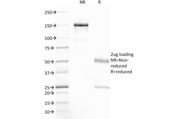 anti-Cystic Fibrosis Transmembrane Conductance Regulator (ATP-Binding Cassette Sub-Family C, Member 7) (CFTR) (AA 258-385) antibody