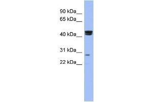 Image no. 1 for anti-Heat Shock Transcription Factor, Y-Linked 1 (HSFY1) (N-Term) antibody (ABIN2778422)