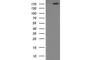 Image no. 8 for anti-Phosphatidylinositol-4-Phosphate 3-Kinase, Catalytic Subunit Type 2 beta (PIK3C2B) antibody (ABIN1500199)