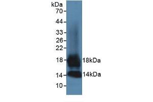 Image no. 6 for Chemokine (C-C Motif) Ligand 7 (CCL7) ELISA Kit (ABIN6574138)
