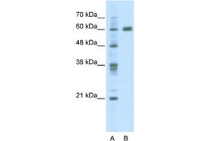 Image no. 1 for anti-PDZ and LIM Domain 5 (PDLIM5) (C-Term) antibody (ABIN2780776)