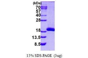 Image no. 1 for Spermidine/Spermine N1-Acetyltransferase 2 (SAT2) protein (His tag) (ABIN1098224)