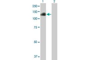 Image no. 1 for anti-DAZ Interacting Protein 1 (DZIP1) (AA 1-867) antibody (ABIN524817)