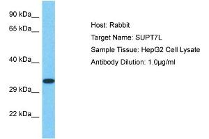 Image no. 1 for anti-Suppressor of Ty 7 Like (SUPT7L) (C-Term) antibody (ABIN2790710)