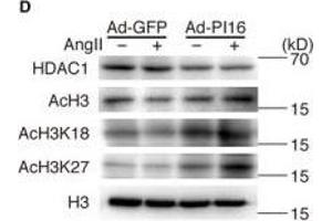 Image no. 17 for anti-Histone Deacetylase 1 (HDAC1) (Center) antibody (ABIN2854776)