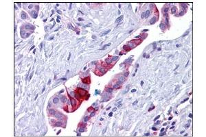 Image no. 3 for anti-Retinoblastoma Binding Protein 8 (RBBP8) antibody (ABIN784052)