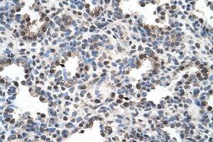 Image no. 1 for anti-Family with Sequence Similarity 134, Member B (FAM134B) (AA 160-209) antibody (ABIN205065)