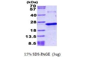 SDS-PAGE (SDS) image for Prepronociceptin (PNOC) (AA 20-176) protein (His tag) (ABIN5852945)