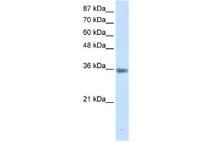 Image no. 1 for anti-Menage A Trois Homolog 1, Cyclin H Assembly Factor (Xenopus Laevis) (MNAT1) (C-Term) antibody (ABIN2780425)