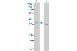 Image no. 3 for anti-Coagulation Factor III (thromboplastin, Tissue Factor) (F3) (AA 45-154) antibody (ABIN560823)