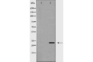 Image no. 2 for anti-CD83 (CD83) antibody (ABIN6260655)