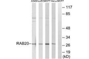 Image no. 1 for anti-RAB20, Member RAS Oncogene Family (RAB20) (AA 115-164) antibody (ABIN1535271)