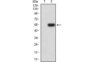 Image no. 4 for anti-Interleukin 2 Receptor, beta (IL2RB) (AA 27-240) antibody (ABIN5611139)