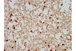 IHC image of ABIN7148507 diluted at 1:300 and staining in paraffin-embedded human brain tissue performed on a Leica BondTM system.