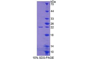 ABCE1 Protein (AA 389-556) (T7 tag,His tag)
