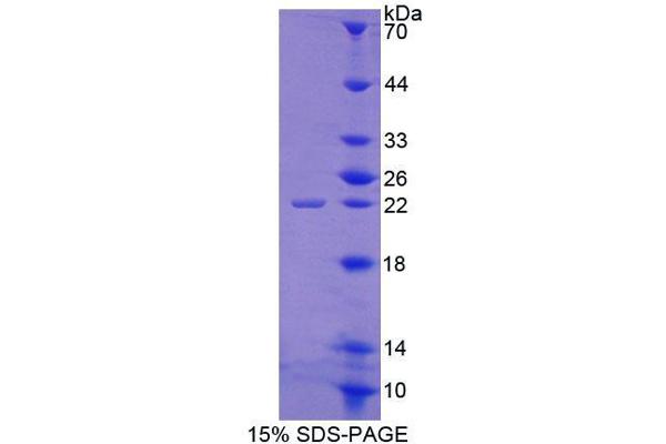ABCE1 Protein (AA 389-556) (T7 tag,His tag)