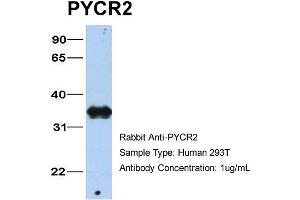 anti-Pyrroline-5-Carboxylate Reductase Family, Member 2 (PYCR2) (C-Term) antibody