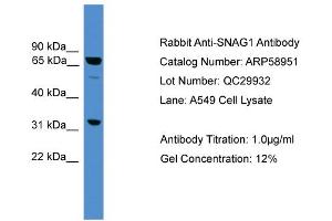 Image no. 2 for anti-Sorting Nexin 18 (SNX18) (Middle Region) antibody (ABIN2787889)